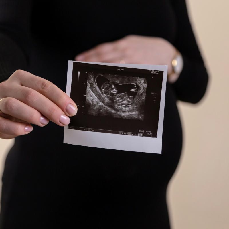 Kobieta w ciąży pokazuje zdjecie USG